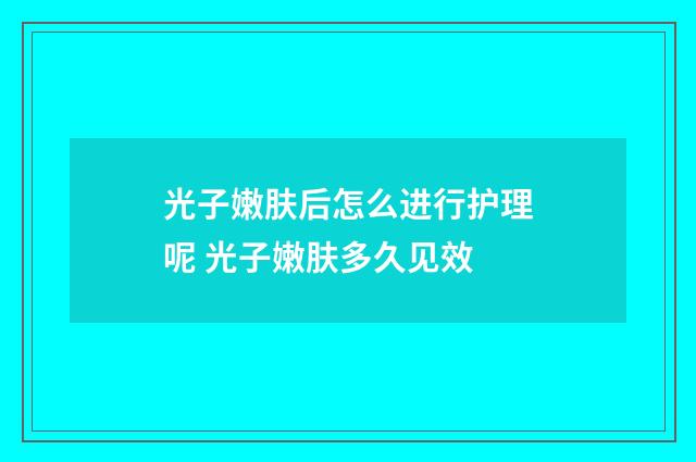 光子嫩肤后怎么进行护理呢 光子嫩肤多久见效