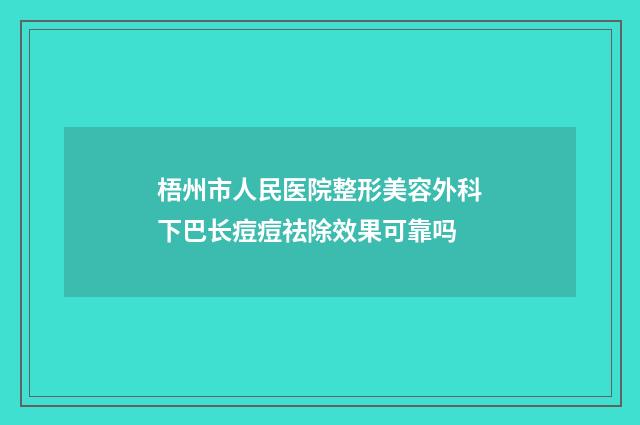梧州市人民医院整形美容外科下巴长痘痘祛除效果可靠吗