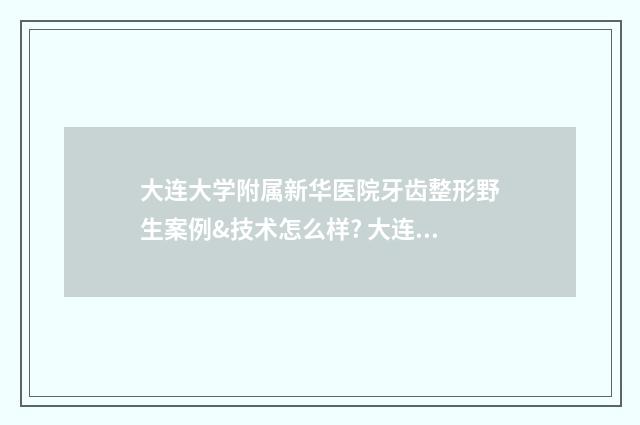 大连大学附属新华医院牙齿整形野生案例&技术怎么样? 大连大学附属新华医院官网