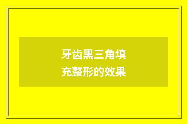牙齿黑三角填充整形的效果