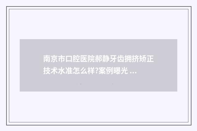 南京市口腔医院郝静牙齿拥挤矫正技术水准怎么样?案例曝光 南京市口腔医院地址