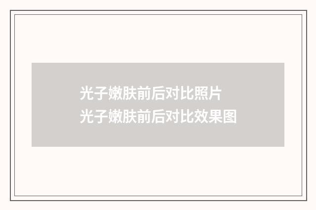 光子嫩肤前后对比照片 光子嫩肤前后对比效果图