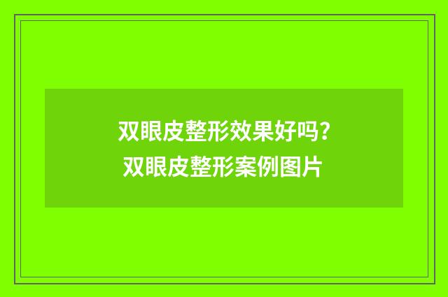 双眼皮整形效果好吗？ 双眼皮整形案例图片