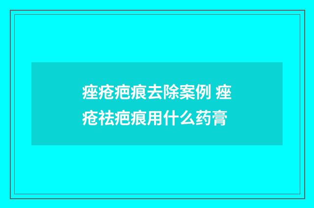 痤疮疤痕去除案例 痤疮祛疤痕用什么药膏