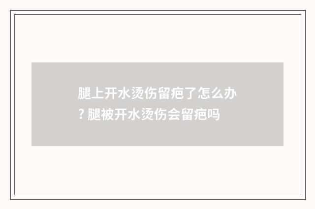 腿上开水烫伤留疤了怎么办? 腿被开水烫伤会留疤吗