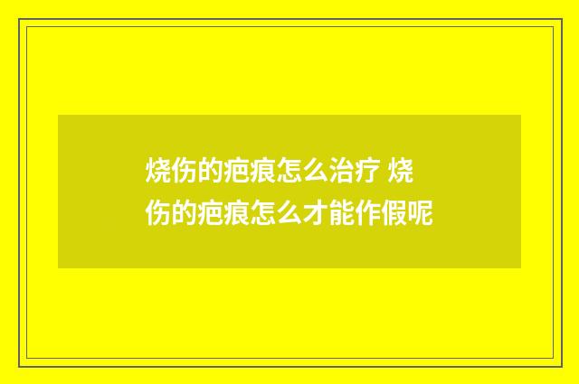 烧伤的疤痕怎么治疗 烧伤的疤痕怎么才能作假呢