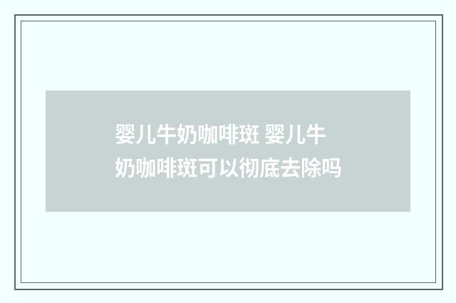 婴儿牛奶咖啡斑 婴儿牛奶咖啡斑可以彻底去除吗