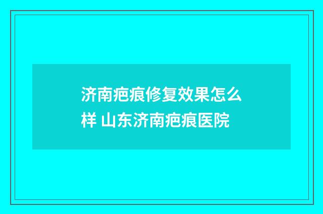 济南疤痕修复效果怎么样 山东济南疤痕医院