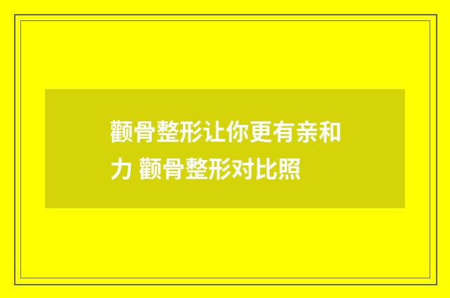 颧骨整形让你更有亲和力 颧骨整形对比照