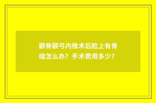颧骨颧弓内推术后脸上有骨缝怎么办？手术费用多少？