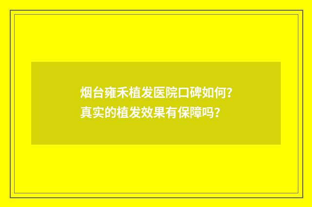 烟台雍禾植发医院口碑如何？真实的植发效果有保障吗？